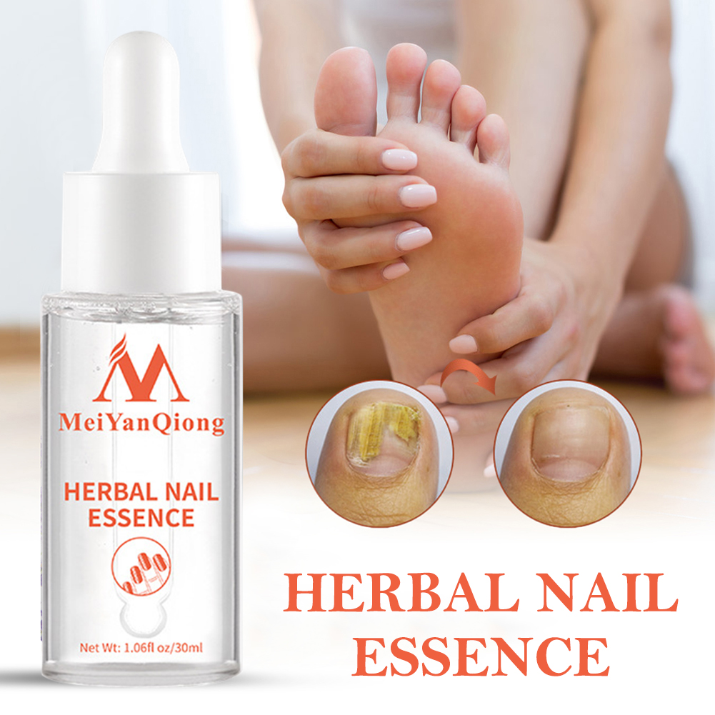 Gel Perawatan Kaki Serum Pemut - Mens Grooming Treatment ulasan dan harga
